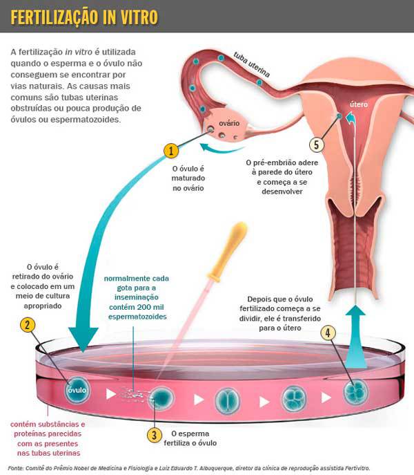 fertilização in vitro